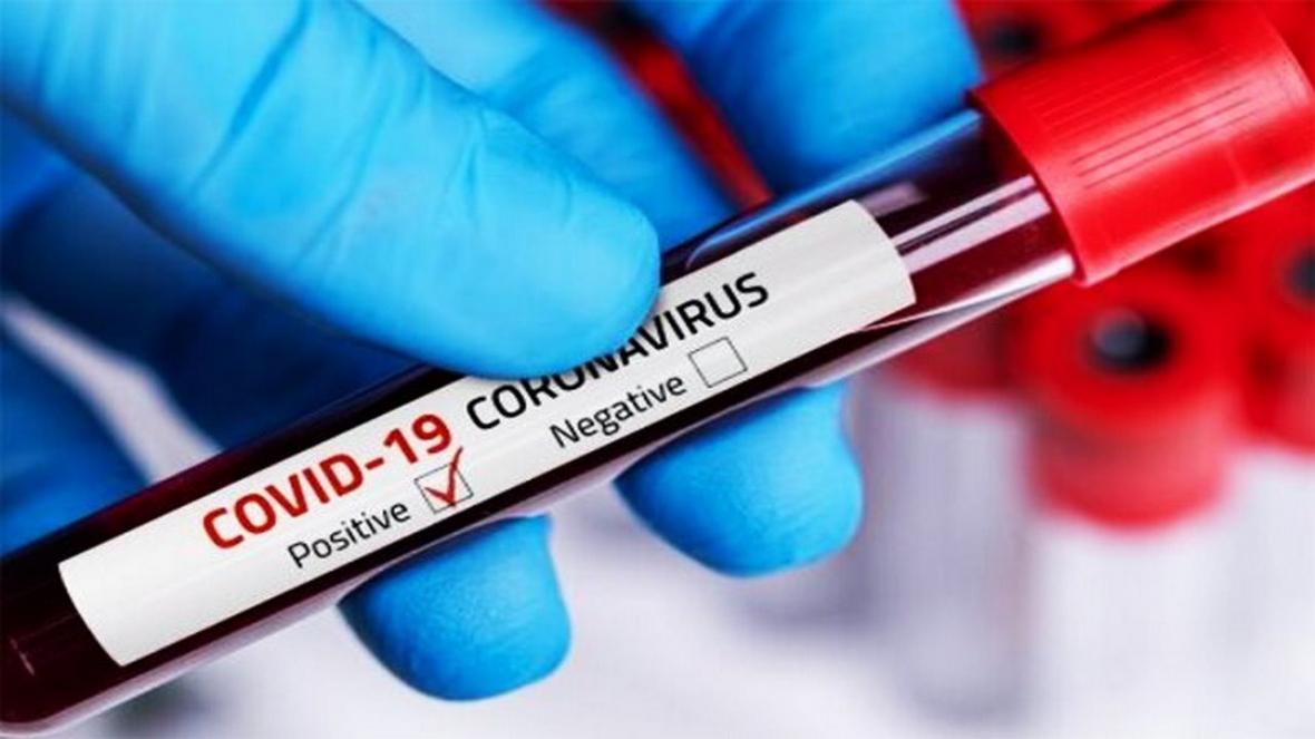شناسایی 38 مورد جدید بیمار مبتلا به کرونا ویروس در ایلام